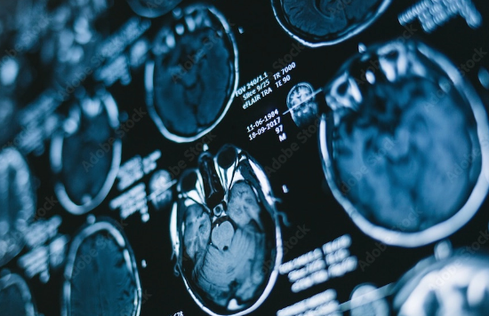 DTS Imagerie médical et radiologie thérapeutique